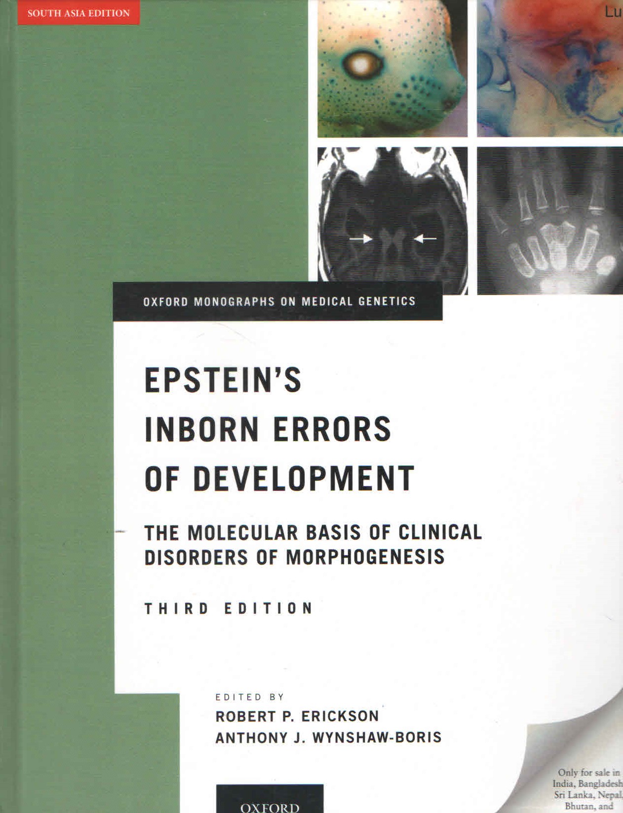 exclusive-publishers/oxford-university-press/epstein-s-inborn-error-of-development:-the-molecular-basis-of-clinical-disorders-of-morphogenesis-9780197770627