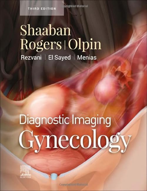 general-books/general/diagnostic-imaging-gynecology-3ed--9780323796927