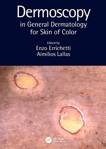 
clinical-sciences/medical/dermoscopy-in-general-dermatology-for-skin-of-color-9780367418403