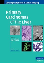 mbbs/4-year/hussain-primary-carcinomas-of-the-liver-9780521519519