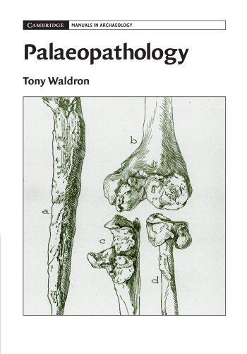
palaeopathology-9780521678551