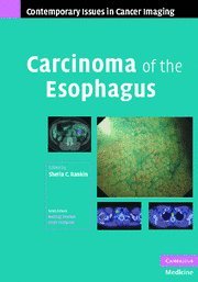 clinical-sciences/radiology/carcinoma-of-the-esophagus-9780521882859