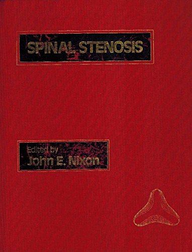 general-books/general/spinal-stenosis--9780713145250