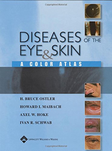 mbbs/3-year/diseases-of-the-eye-skin-a-color-atlas-9780781749992