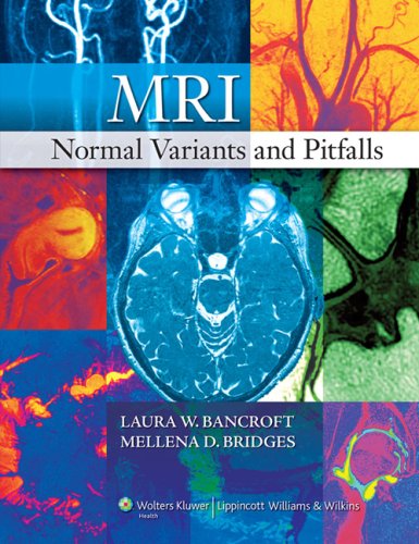 mbbs/4-year/mri-normal-variants-and-pitfalls-9780781783149