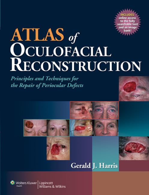 exclusive-publishers/lww/atlas-of-oculofacial-reconstruction--9780781796514