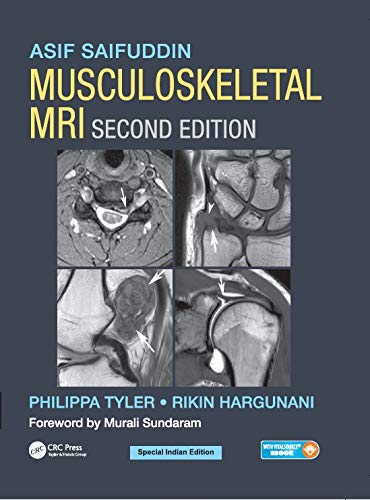 
musculoskeletal-mri-2-ed-9781032024059