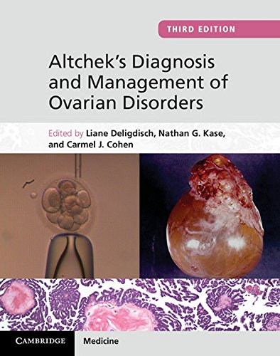 ALTCHEKS DIAGNOSIS AND MANAGEMENT OF OVARIAN DISORDERS- ISBN: 9781107012813