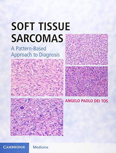 general-books/general/soft-tissue-sarcomas-hardback-with-online-resource-9781107040809