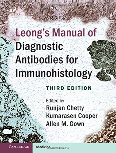 general-books/general/leong-s-manual-of-diagnostic-antibodies-for-immunohistology-3ed--9781107077782