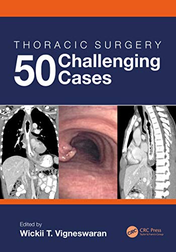 exclusive-publishers/taylor-and-francis/thoracic-surgery-50-challenging-cases-9781138035652