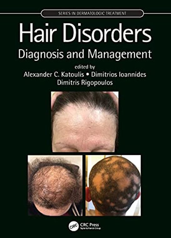 
hair-disorders-diagnosis-and-management-9781138611900