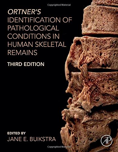 
ortner-s-identification-of-pathological-conditions-in-human-skeletal-remains-9780128097380