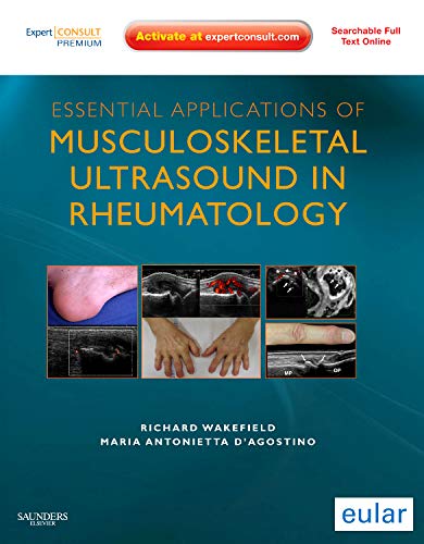 mbbs/4-year/essential-applications-of-musculoskeletal-ultrasound-in-rheumatology-expert-consult-premium-edition-enhanced-online-features-and-print-1e-9781437701272