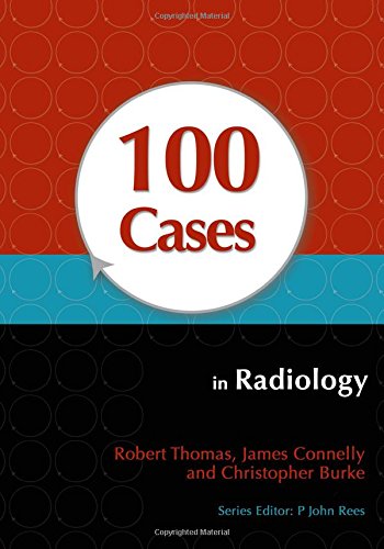 100 CASES IN RADIOLOGY- ISBN: 9781444123319