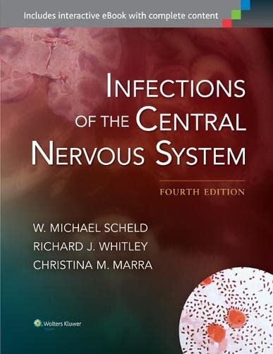 
basic-sciences/microbiology/infections-of-the-central-nervous-system-9781451173727