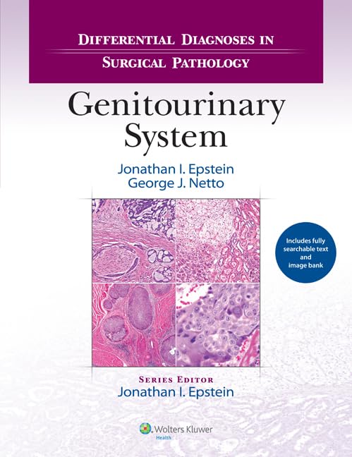 exclusive-publishers/lww/differential-diagnoses-in-surgical-pathology-genitourinary-system1-ed--9781451189582