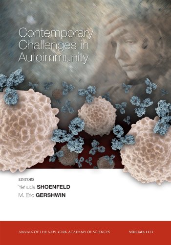 general-books/general/contemporary-challenges-in-autoimmunity--9781573317627