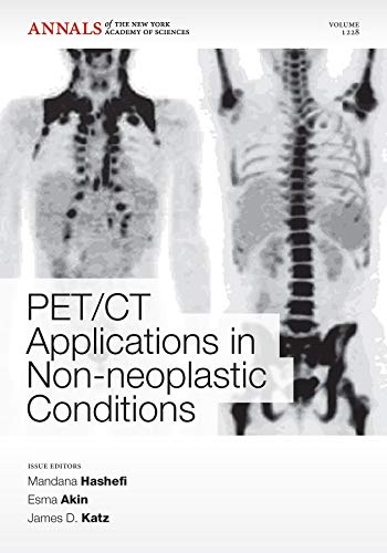 mbbs/4-year/pet-ct-applications-in-non-neoplastic-conditions--9781573318181