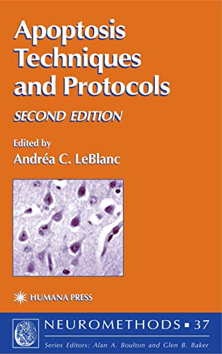 

basic-sciences/biochemistry/apoptosis-techniques-and-protocols-2ed-9781588290120