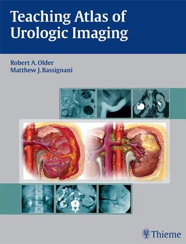 
teaching-atlas-of-urologic-imaging-9781604060164