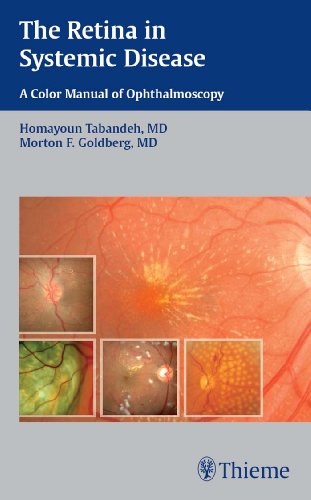 
the-retina-in-systemic-disease-a-color-manual-of-ophthalmoscopy-1-e--9781604060553