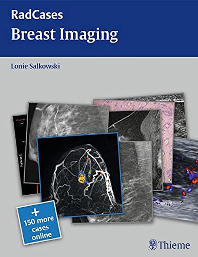 
radcases-breast-imaging-1-e-9781604061918