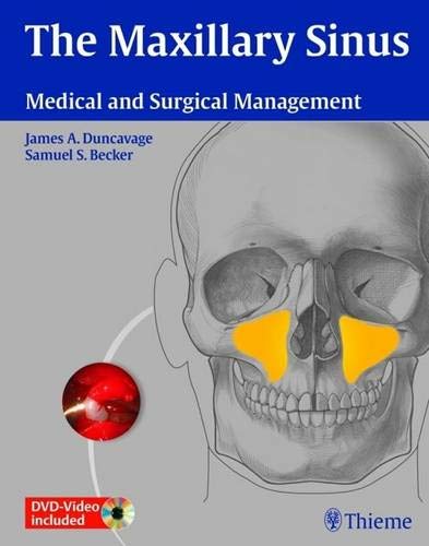 
the-maxillary-sinus-medical-and-surgical-management-1-e--9781604062809