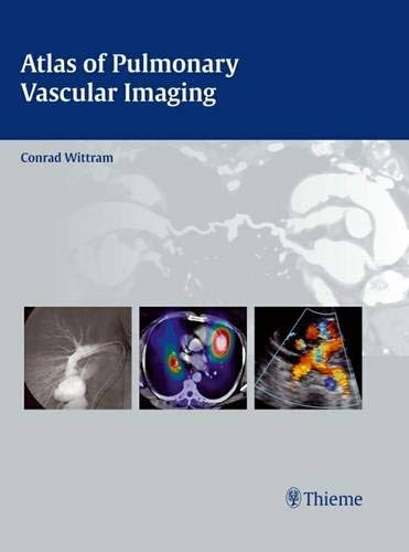 
atlas-of-pulmonary-vascular-imaging-1-e--9781604063127