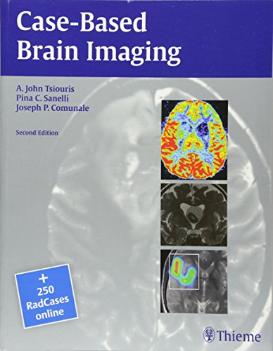 
case--based-brain-imaging-2ed-9781604069532