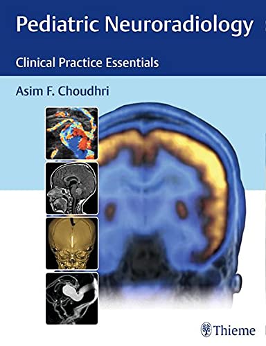 exclusive-publishers/thieme-medical-publishers/pediatric-neuroradiology-the-essentials-1-e--9781626230965