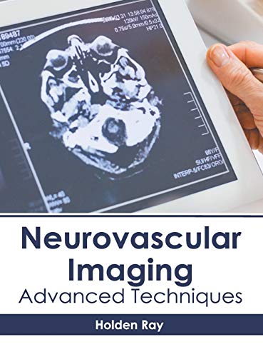 general-books/general/neurovascular-imaging-advanced-techniques--9781632415820