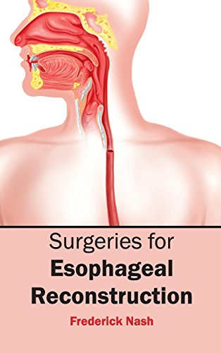 SURGERIES FOR ESOPHAGEAL RECONSTRUCTION- ISBN: 9781632423832