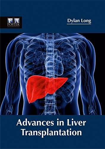 ADVANCES IN LIVER TRANSPLANTATION- ISBN: 9781632424730