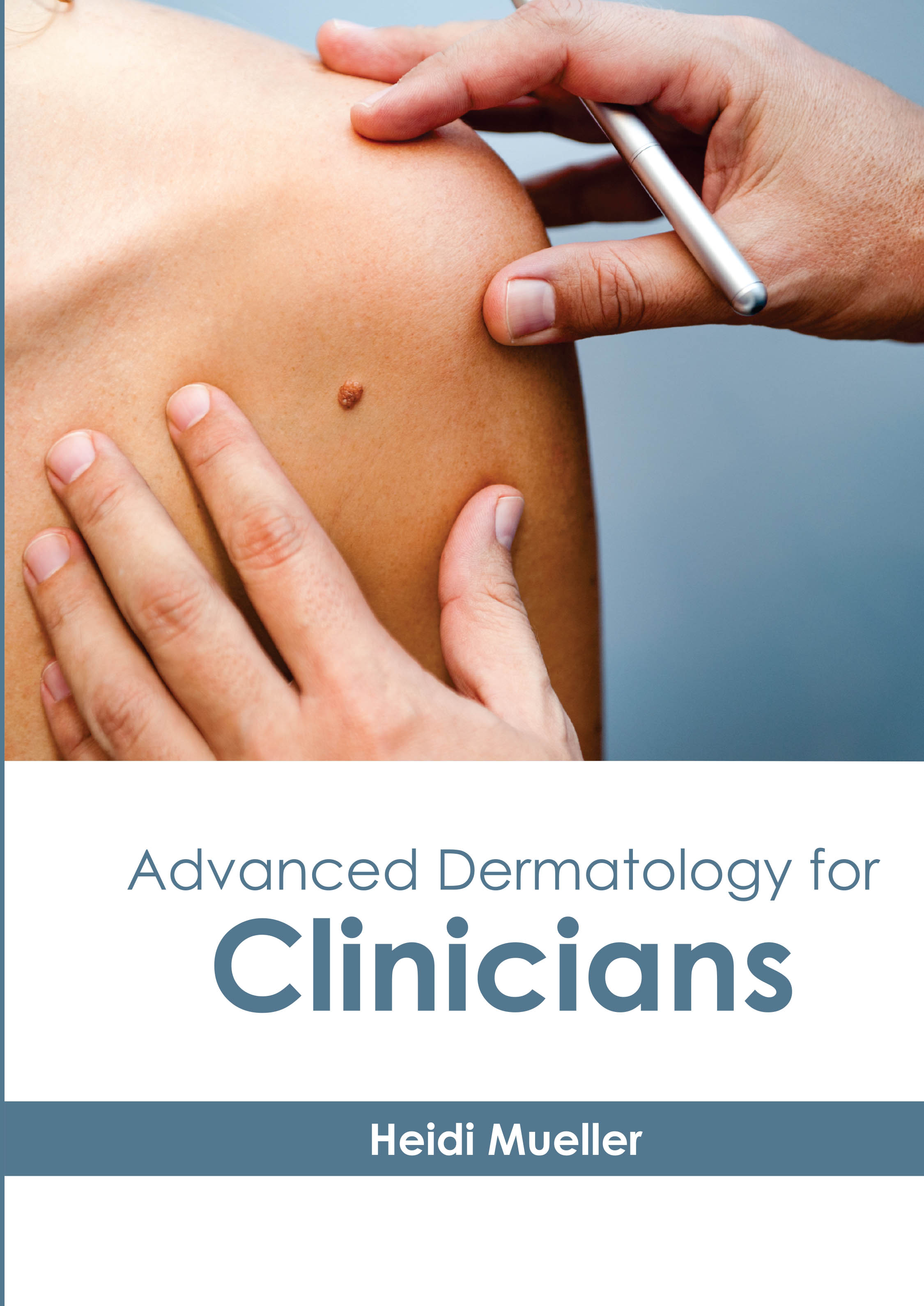 
exclusive-publishers/american-medical-publishers/advanced-dermatology-for-clinicians-9781639270637