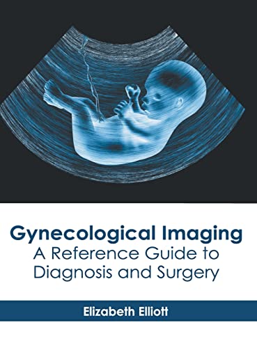 
exclusive-publishers/american-medical-publishers/gynecological-imaging-a-reference-guide-to-diagnosis-and-surgery-9781639270712