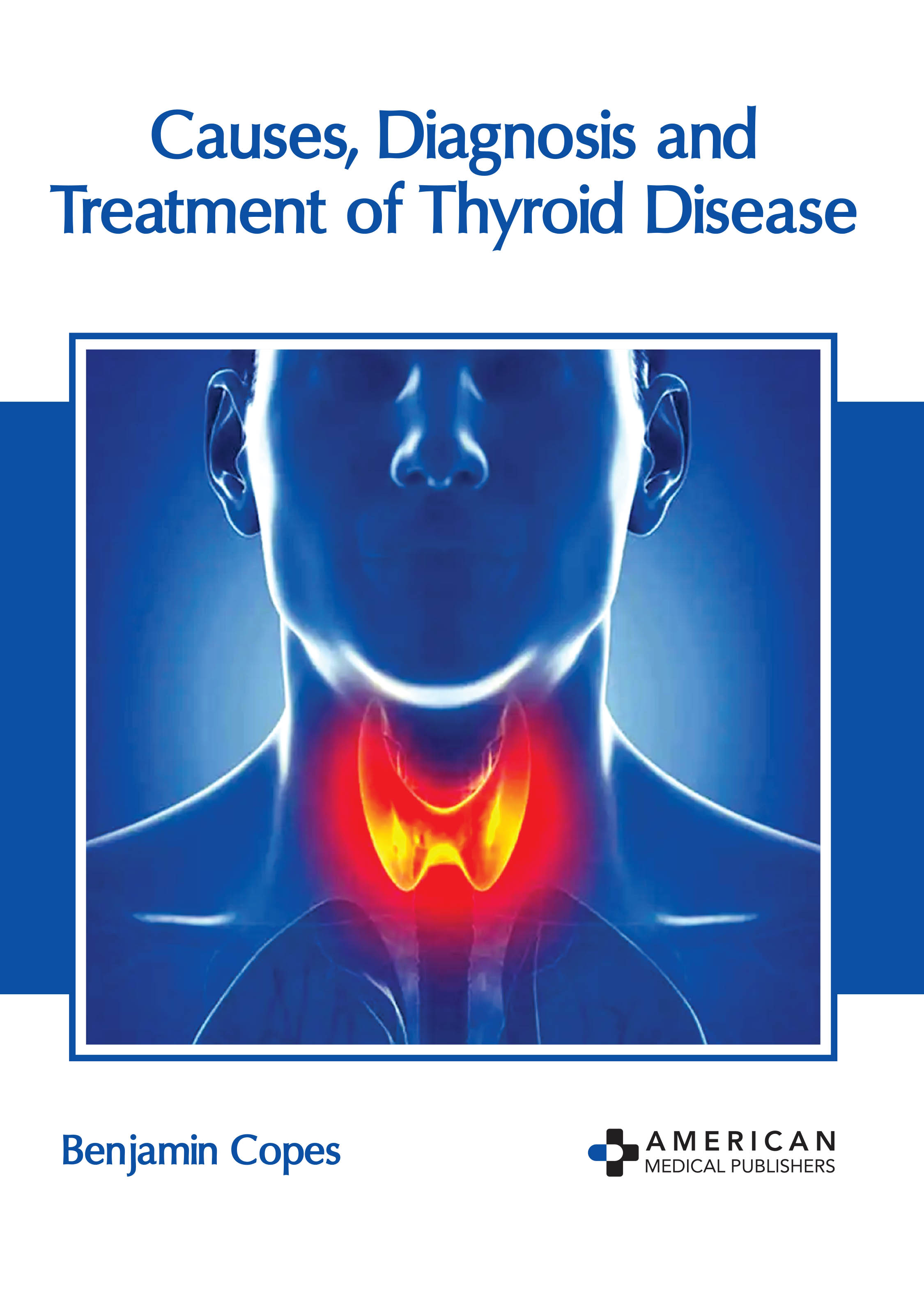 CAUSES, DIAGNOSIS AND TREATMENT OF THYROID DISEASE