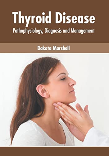 THYROID DISEASE: PATHOPHYSIOLOGY, DIAGNOSIS AND MANAGEMENT