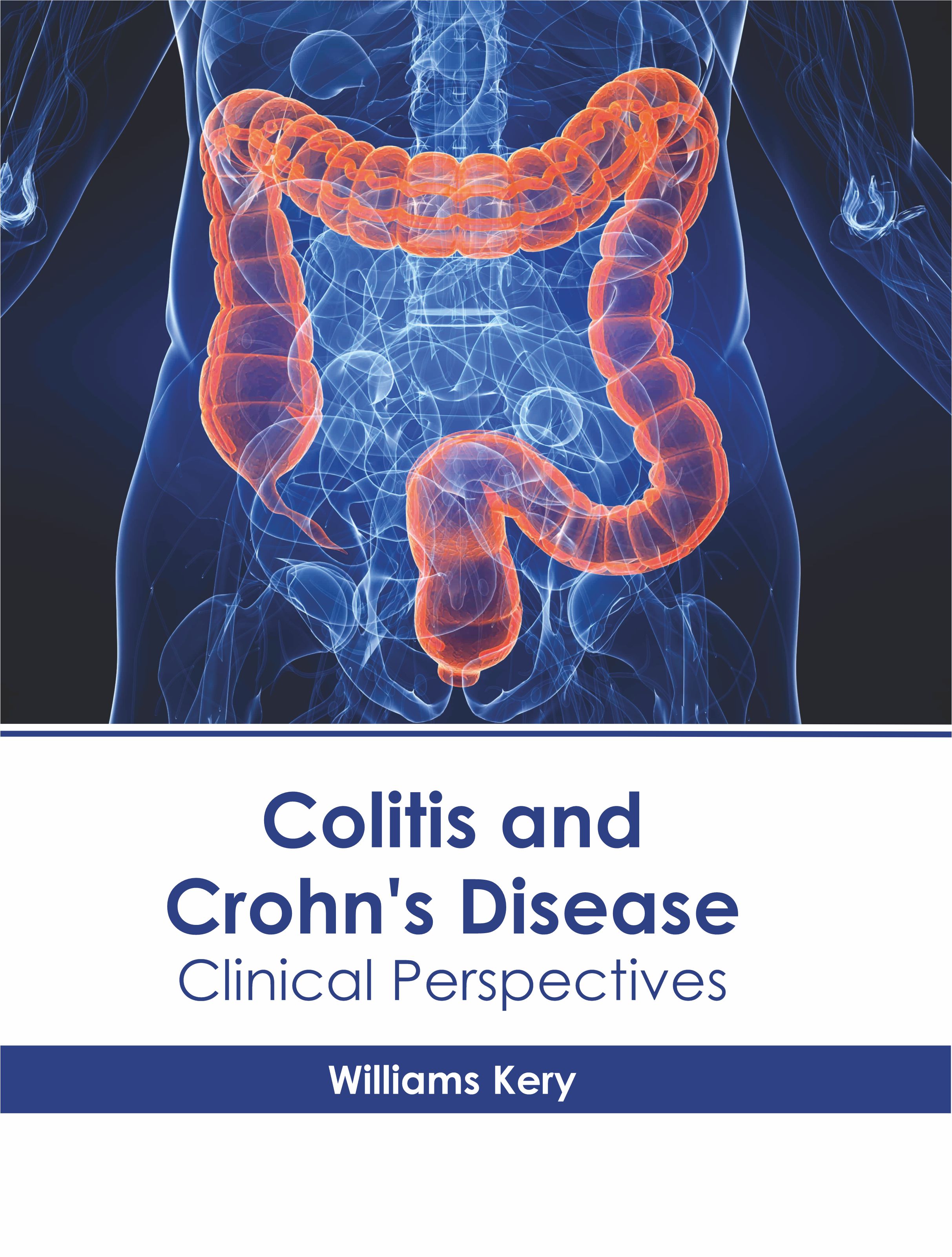 COLITIS AND CROHN'S DISEASE: CLINICAL PERSPECTIVES