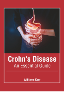 CROHN'S DISEASE: AN ESSENTIAL GUIDE