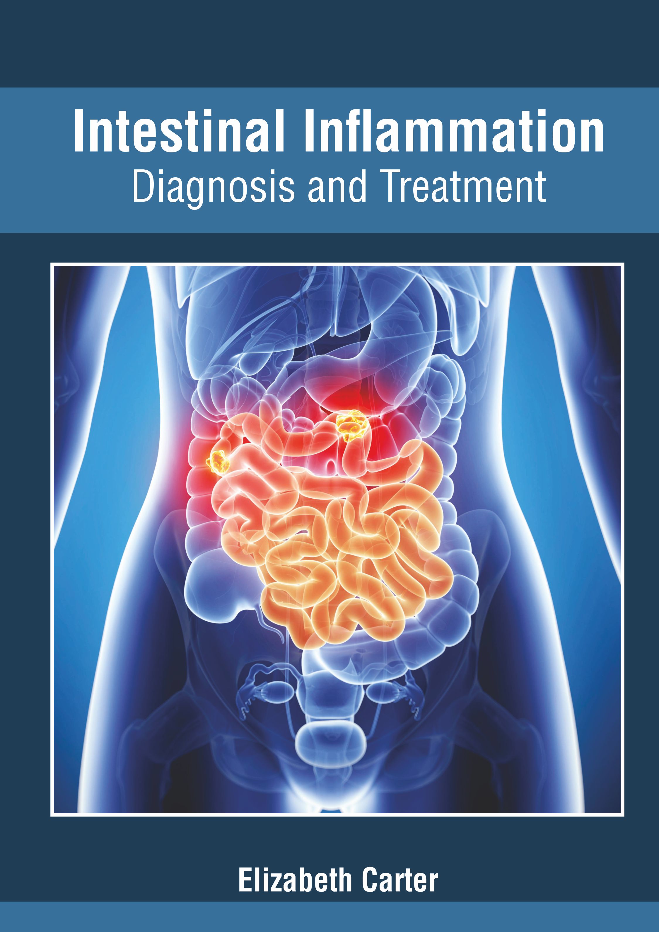 
exclusive-publishers/american-medical-publishers/intestinal-inflammation-diagnosis-and-treatment-9781639271450