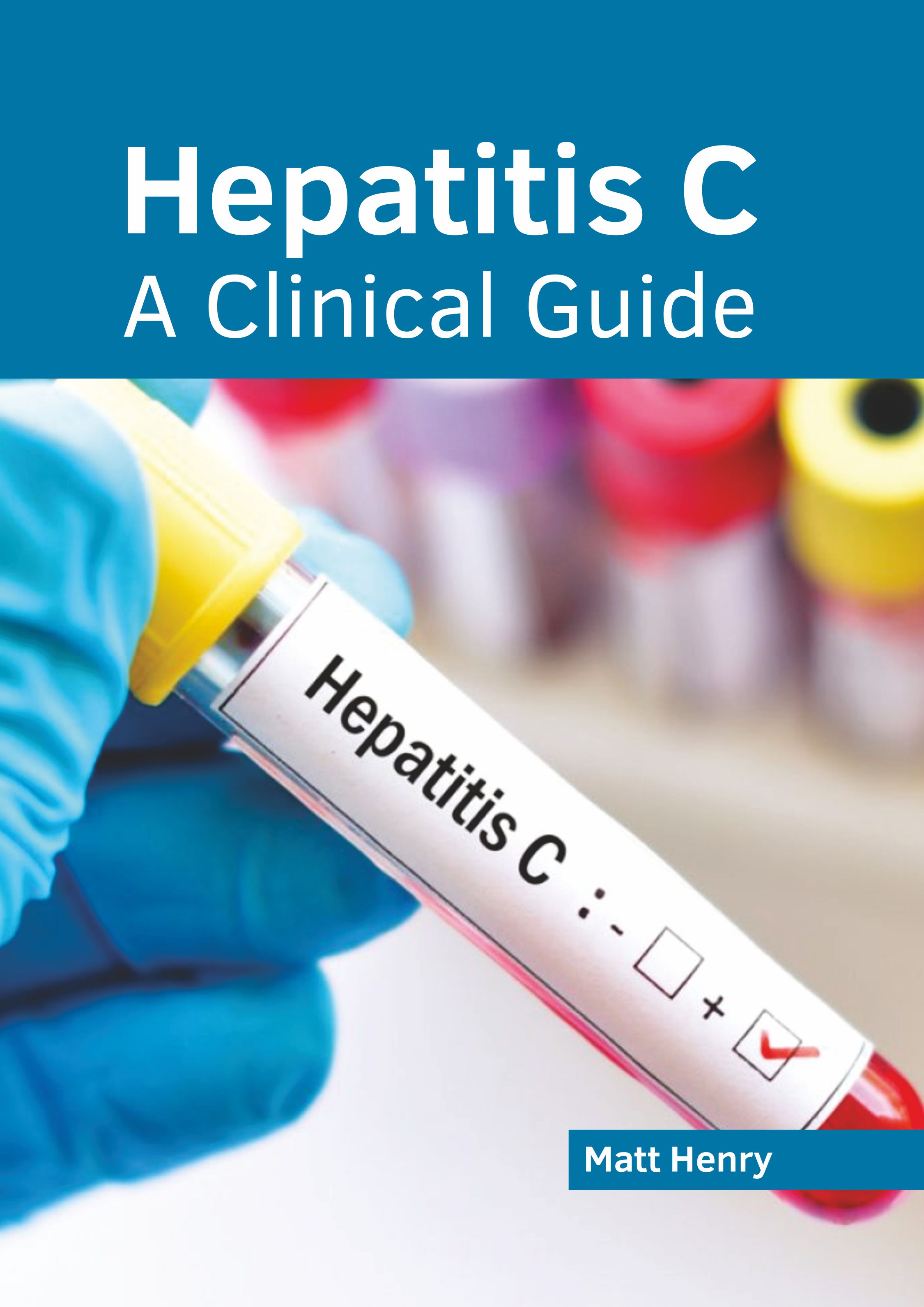 
exclusive-publishers/american-medical-publishers/hepatitis-c-a-clinical-guide-9781639271894