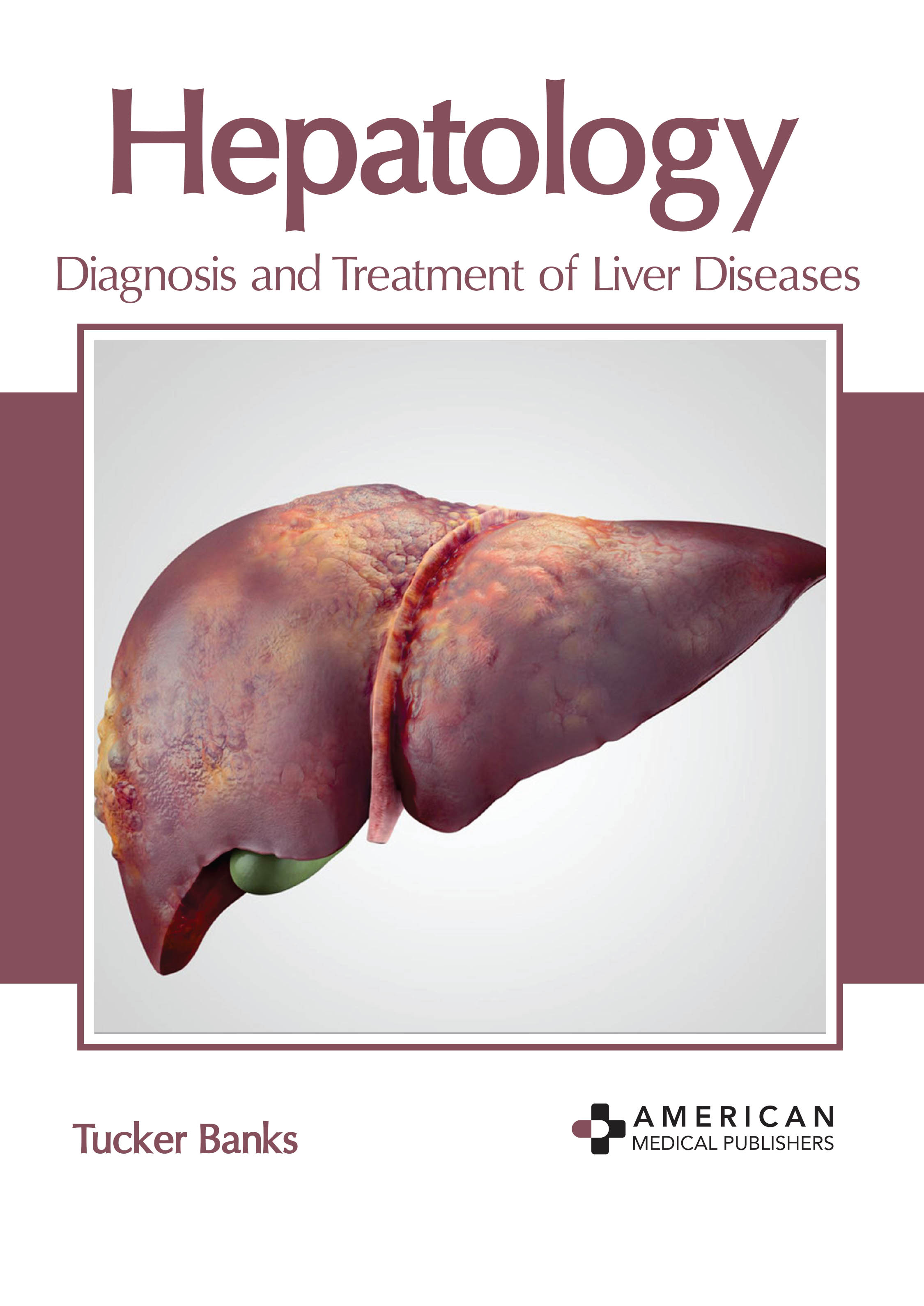 HEPATOLOGY: DIAGNOSIS AND TREATMENT OF LIVER DISEASES