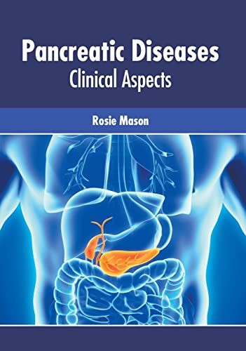 exclusive-publishers/american-medical-publishers/pancreatic-diseases-clinical-aspects-9781639271979