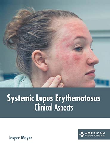 SYSTEMIC LUPUS ERYTHEMATOSUS: CLINICAL ASPECTS- ISBN: 9781639272129