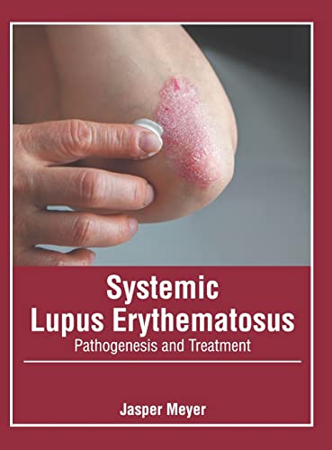 SYSTEMIC LUPUS ERYTHEMATOSUS: PATHOGENESIS AND TREATMENT | ISBN: 9781639272136