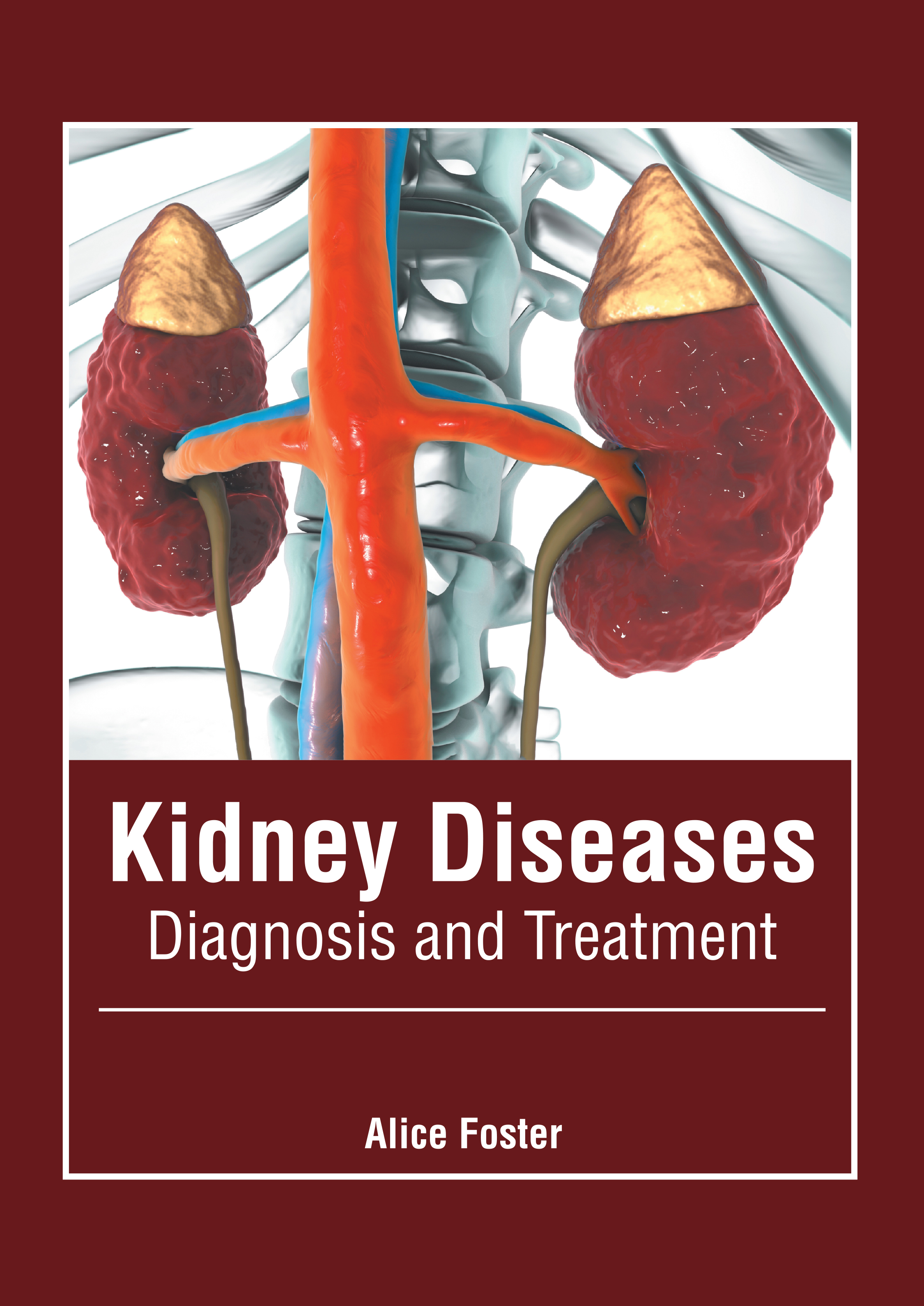 KIDNEY DISEASES: DIAGNOSIS AND TREATMENT