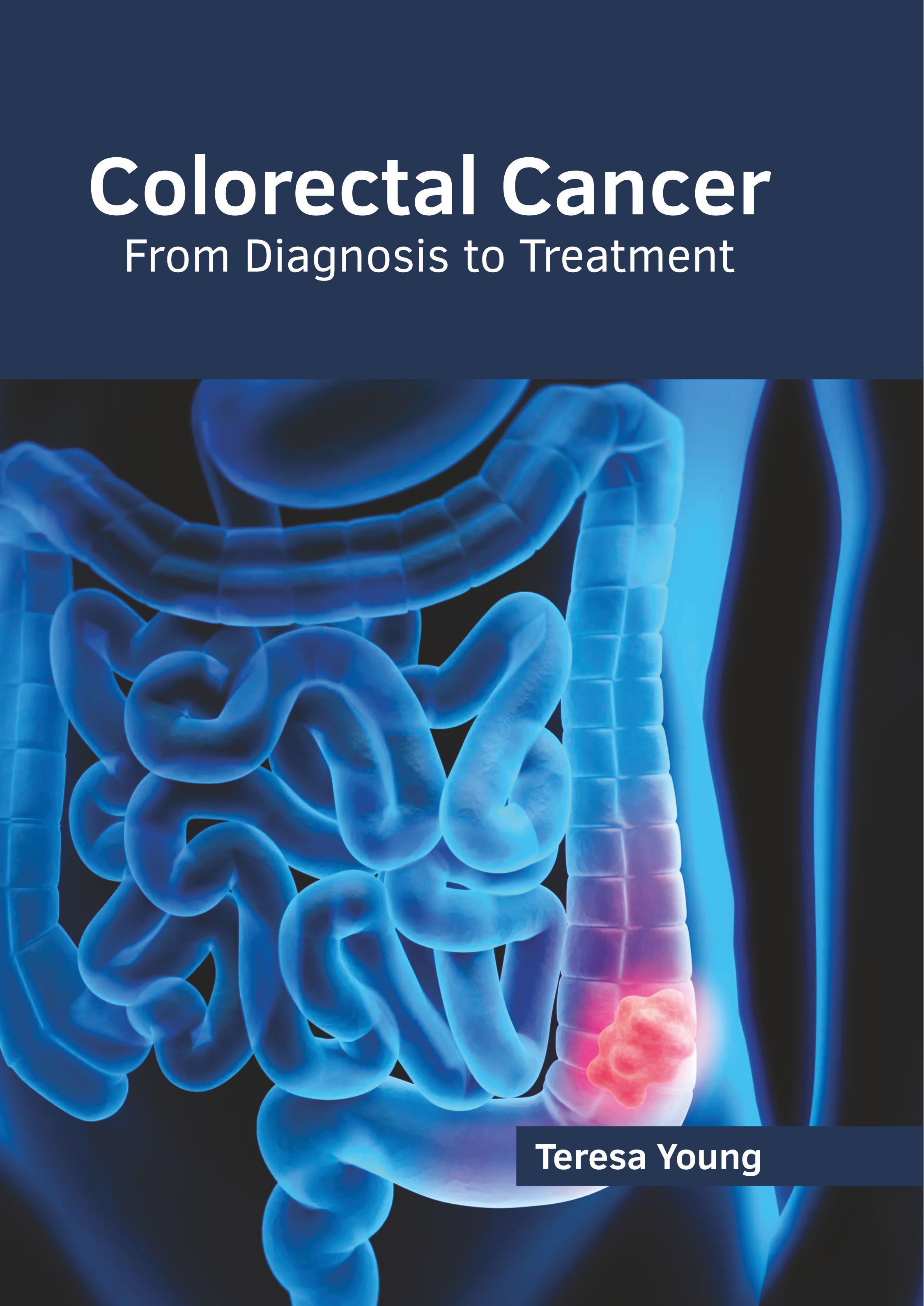 COLORECTAL CANCER: FROM DIAGNOSIS TO TREATMENT