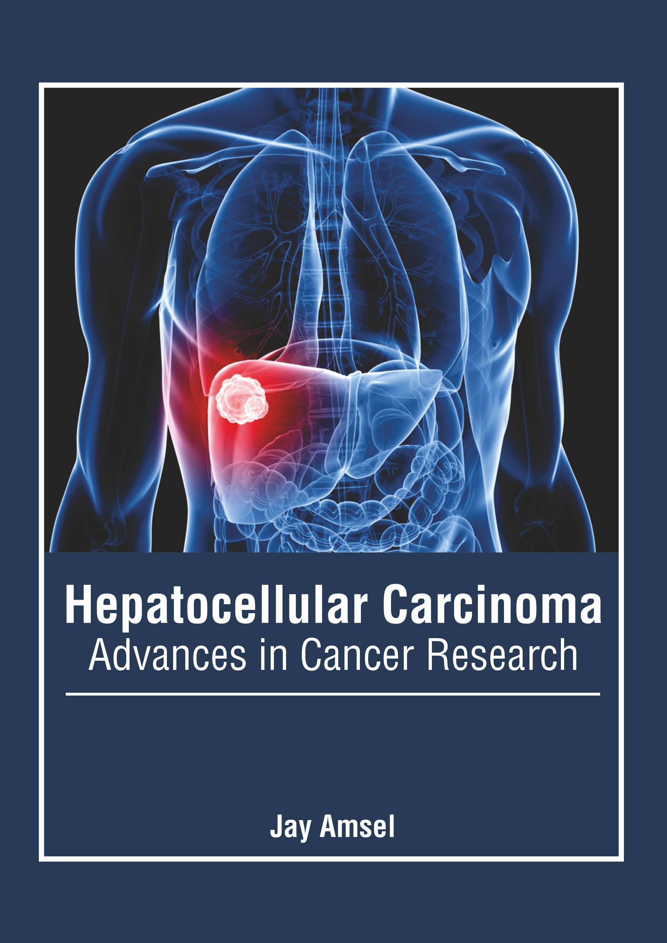 HEPATOCELLULAR CARCINOMA: ADVANCES IN CANCER RESEARCH