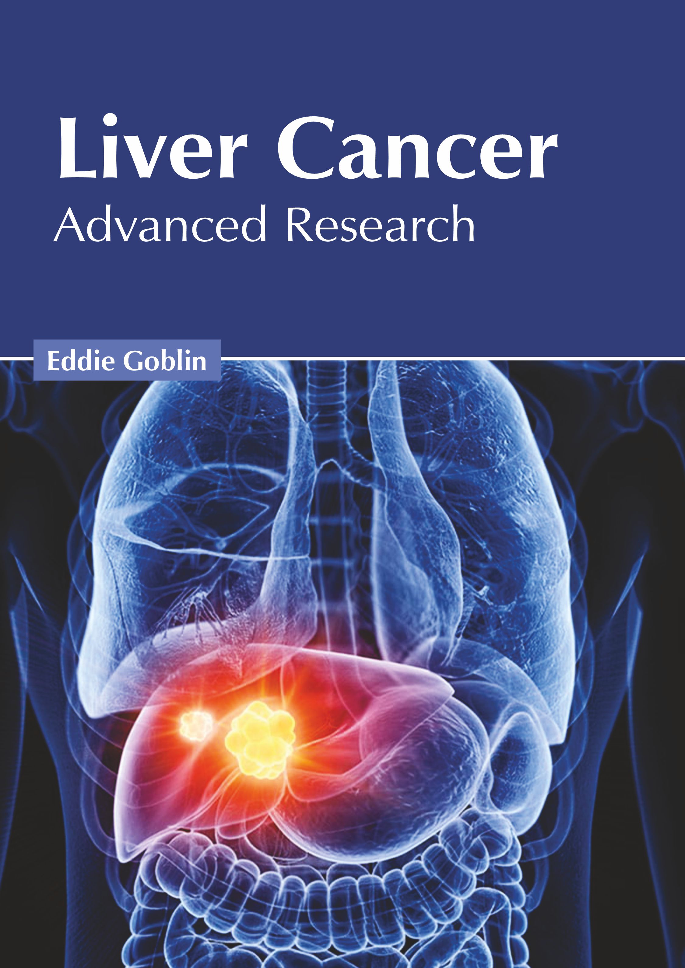LIVER CANCER: ADVANCED RESEARCH